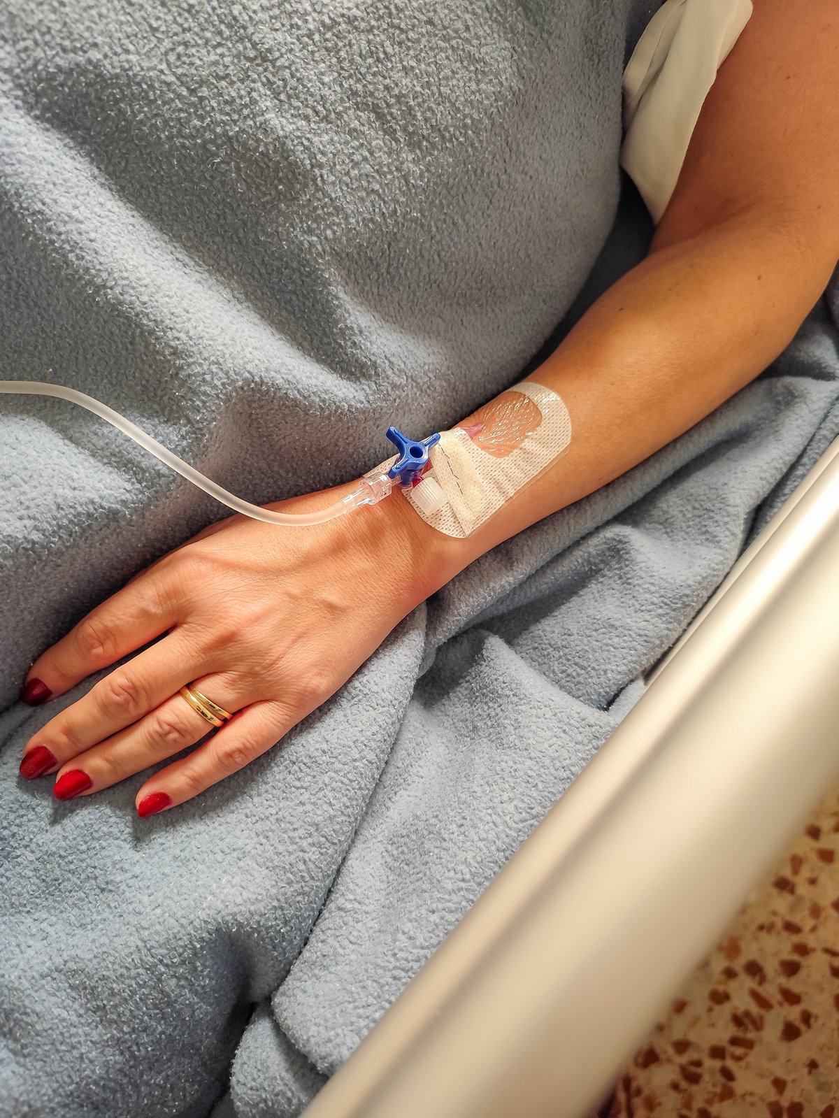 IV cannula secured on patient hand